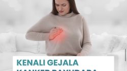 Kenali Gejala Kanker Payudara Sebelum Terlambat