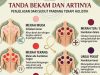 Bekam dalam Ajaran Rasulullah SAW: Antara Sunnah, Riwayat Hadis, dan Praktik Kesehatan