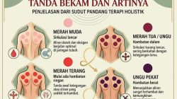 Bekam dalam Ajaran Rasulullah SAW: Antara Sunnah, Riwayat Hadis, dan Praktik Kesehatan
