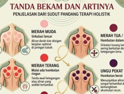 Bekam dalam Ajaran Rasulullah SAW: Antara Sunnah, Riwayat Hadis, dan Praktik Kesehatan
